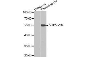 Western Blotting (WB) image for anti-Tumor Protein P53 (TP53) (pSer6) antibody (ABIN1870678) (p53 antibody  (pSer6))