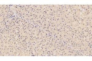 Detection of ADPN in Porcine Liver Tissue using Monoclonal Antibody to Adiponectin (ADPN) (ADIPOQ antibody  (AA 18-243))