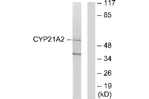 Western blot analysis of extracts from 293 cells, using Cytochrome P450 21A2 antibody. (CYP21A2 antibody)