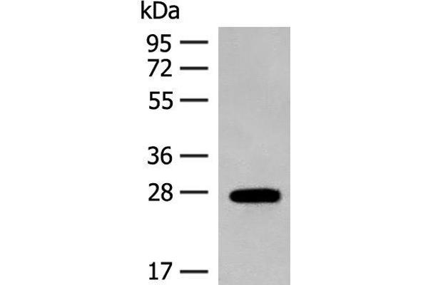 GUCA1B antibody