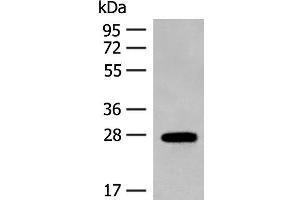 Western blot analysis of Mouse eye tissue lysate using GUCA1B Polyclonal Antibody at dilution of 1:500