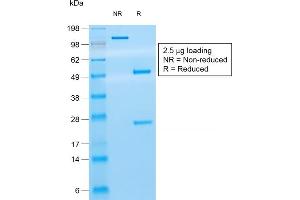 SDS-PAGE Analysis Purified CD8 Mouse Recombinant Monoclonal Antibody (rC8/468). (Recombinant CD8 alpha antibody)