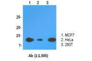 The cell lysates (30 ug) were resolved by SDS-PAGE, transferred to PVDF membrane and probed with LSm2 antibody (1:1,000). (LSM2 antibody  (AA 1-95))