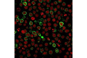 Immunofluorescence staining of Ramos cells using CD10 Mouse Monoclonal Antibody (FR4D11) followed by goat anti-Mouse IgG conjugated to CF488 (green). (MME antibody)