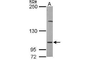 Western Blotting (WB) image for anti-Eukaryotic Translation Initiation Factor 4 gamma 2 (EIF4G2) (C-Term) antibody (ABIN2855138)