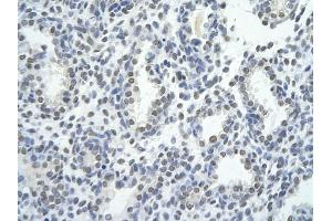 Rabbit Anti-ZNF264 antibody         Paraffin Embedded Tissue:  Human Lung    cell Cellular Data:  alveolar cell    Antibody Concentration:  4. (ZNF264 antibody  (C-Term))