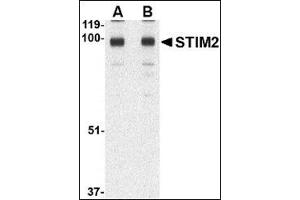 Western blot analysis of STIM2 in A-20 cell lysate AP30838PU-N at (A) 0. (Stim2 antibody  (C-Term))