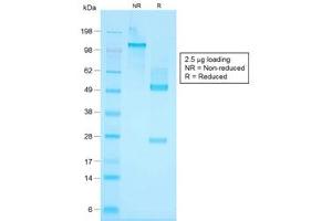SDS-PAGE analysis of purified, BSA-free recombinant Basic Cytokeratin antibody (clone KRTH/1576R) as confirmation of integrity and purity.