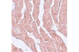 Immunohistochemical staining of mouse heart tissue with LZTR1 polyclonal antibody  at 5 ug/mL dilution. (LZTR1 antibody  (N-Term))