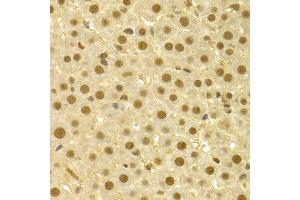 Immunohistochemistry of paraffin-embedded rat liver using CDC25A antibody (ABIN5970519) at dilution of 1/100 (40x lens). (CDC25A antibody)