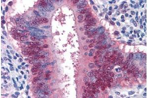 Immunohistochemistry (Formalin-fixed Paraffin-embedded Sections) (IHC (fp)) image for anti-Yes-Associated Protein 1 (YAP1) (AA 53-162) antibody (ABIN574419)