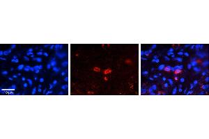Rabbit Anti-CLN6 Antibody     Formalin Fixed Paraffin Embedded Tissue: Human Pineal Tissue  Observed Staining: Cytoplasmic in cell bodies of pinealocytes  Primary Antibody Concentration: 1:100  Other Working Concentrations: 1/600  Secondary Antibody: Donkey anti-Rabbit-Cy3  Secondary Antibody Concentration: 1:200  Magnification: 20X  Exposure Time: 0.