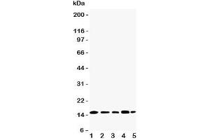 Western blot testing of TIA-1 antibody and Lane 1:  Jurkat;  2: Raji;  3: CEM;  4: HT1080;  5: K562 cell lysate.