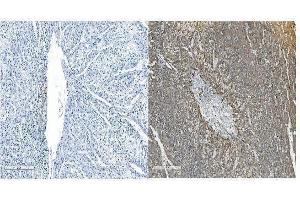 IHC analysis of OB Cadherin/CDH11 using anti-OB Cadherin/CDH11 antibody (ABIN5518978). (OB Cadherin antibody  (AA 55-293))