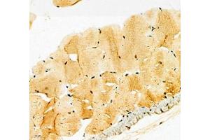 Immunohistochemistry of paraffin embedded mouse Skeletal muscle using Kcnh5 (ABIN7075159) at dilution of 1:100 (400x lens) (KCNH5 antibody)