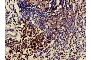 Immunohistochemistry of paraffin-embedded human spleen tissue using ABIN7171382 at dilution of 1:100 (CD3 epsilon antibody  (AA 23-126))
