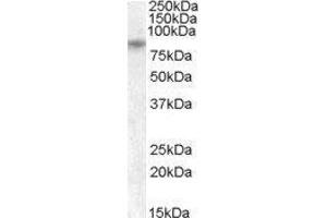 Western Blotting (WB) image for Transient Receptor Potential Cation Channel, Subfamily V, Member 5 (TRPV5) peptide (ABIN369875)