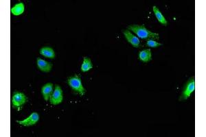 Immunofluorescent analysis of HepG2 cells using ABIN7154324 at dilution of 1:100 and Alexa Fluor 488-congugated AffiniPure Goat Anti-Rabbit IgG(H+L) (Golgin A3 antibody  (AA 217-405))