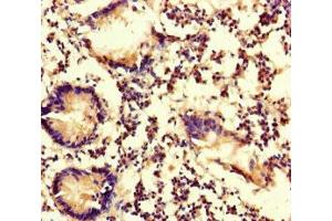 Immunohistochemistry of paraffin-embedded human appendix tissue using ABIN7174949 at dilution of 1:100 (MYO1G antibody  (AA 209-389))