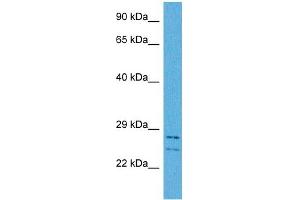 Host:  Rabbit  Target Name:  CSRP3  Sample Tissue:  Human HCT116 Whole Cell  Antibody Dilution:  1ug/ml (CSRP3 antibody  (Middle Region))