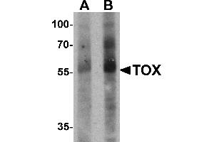 Western blot analysis of TOX in human colon tissue lysate with TOX antibody at (A) 1 and (B) 2 µg/mL. (TOX antibody  (N-Term))