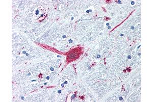 Anti-DRD3 / Dopamine Receptor D3 antibody IHC of human brain, globus pallidus. (DRD3 antibody  (Cytoplasmic Domain))