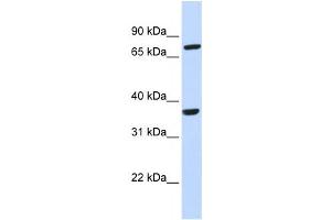 Western Blotting (WB) image for anti-Chemokine (C-C Motif) Receptor-Like 2 (CCRL2) antibody (ABIN2458062)