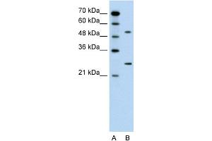 Western Blotting (WB) image for anti-Calcium Channel, Voltage-Dependent, beta 1 Subunit (CACNB1) (Middle Region) antibody (ABIN2776353)
