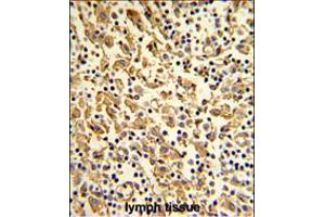 Formalin-fixed and paraffin-embedded human lymph with XPOT Antibody (N-term), which was peroxidase-conjugated to the secondary antibody, followed by DAB staining. (XPOT antibody  (N-Term))