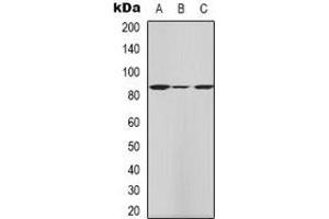 Western blot analysis of HGS expression in Hela (A), mouse kidney (B), mouse testis (C) whole cell lysates. (HGS antibody)