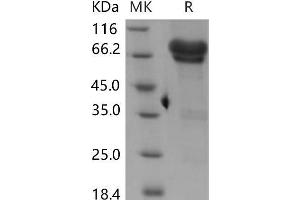 NGFR Protein (Fc Tag)