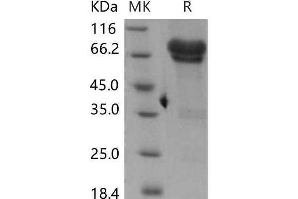 NGFR Protein (Fc Tag)