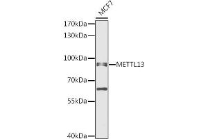 Western blot analysis of extracts of MCF7 cells, using METTL13 antibody (ABIN6131842, ABIN6143755, ABIN6143757 and ABIN6216265) at 1:1000 dilution. (METTL13 antibody  (AA 430-699))