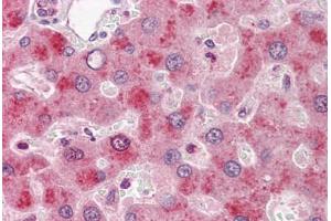 Human Liver: Formalin-Fixed, Paraffin-Embedded (FFPE) (Coagulation Factor IX antibody)