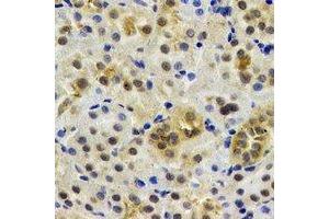 Immunohistochemical analysis of Rent2 staining in rat kidney formalin fixed paraffin embedded tissue section. (RENT2/UPF2 antibody)