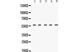 Western Blotting (WB) image for anti-Lymphocyte-Specific Protein tyrosine Kinase (LCK) (AA 468-506), (C-Term) antibody (ABIN3043870) (LCK antibody  (C-Term))