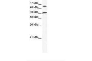 Image no. 1 for anti-Zinc Finger Protein 768 (ZNF768) (AA 80-129) antibody (ABIN202708)