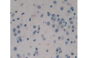 Figure. (NPEPPS antibody  (AA 584-755))