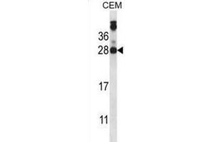 Western Blotting (WB) image for anti-Junctional Adhesion Molecule 2 (JAM2) antibody (ABIN2997813)