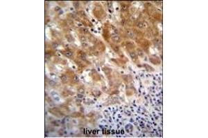 FAH Antibody (N-term) (ABIN655906 and ABIN2845306) immunohistochemistry analysis in formalin fixed and paraffin embedded human liver tissue followed by peroxidase conjugation of the secondary antibody and DAB staining. (FAH antibody  (N-Term))