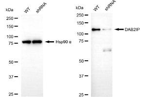 Western blotting analysis using DAB2IP antibody (ABIN7798271).