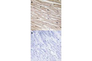 Immunohistochemical staining (Formalin-fixed paraffin-embedded sections) of human heart tissue with PEA15 (phospho S104) polyclonal antibody  without blocking peptide (A) or preincubated with blocking peptide (B) under 1:50-1:100 dilution.