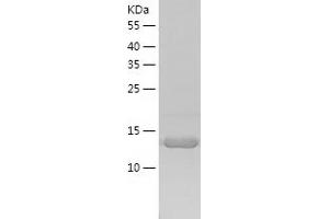 Western Blotting (WB) image for Peptidyl-tRNA Hydrolase 2 (PTRH2) (AA 64-179) protein (His tag) (ABIN7124339) (PTRH2 Protein (AA 64-179) (His tag))