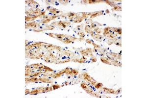 Anti-SDHB antibody, IHC(P) IHC(P): Rat Cardiac Muscle Tissue