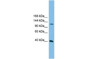 WB Suggested Anti-MAP3K14  Antibody Titration: 0. (MAP3K14 antibody  (N-Term))