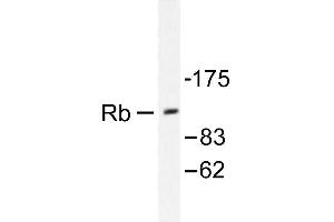 Image no. 1 for anti-Retinoblastoma 1 (RB1) antibody (ABIN271803) (Retinoblastoma 1 antibody)