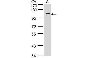 AGAP3 Antikörper  (C-Term)