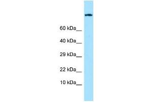 WB Suggested Anti-EMR1 Antibody Titration: 1.