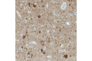 Immunohistochemical staining (Formalin-fixed paraffin-embedded sections) of human cerebral cortex with NECAB1 monoclonal antibody, clone CL0580  shows immunoreactivity in a subset of neuronal cells. (NECAB1 antibody)