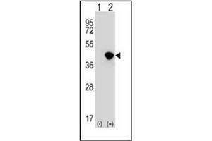 Western blot analysis of DFFA (arrow) using DFFA / ICAD Antibody (C-term) Cat. (DFFA antibody  (C-Term))